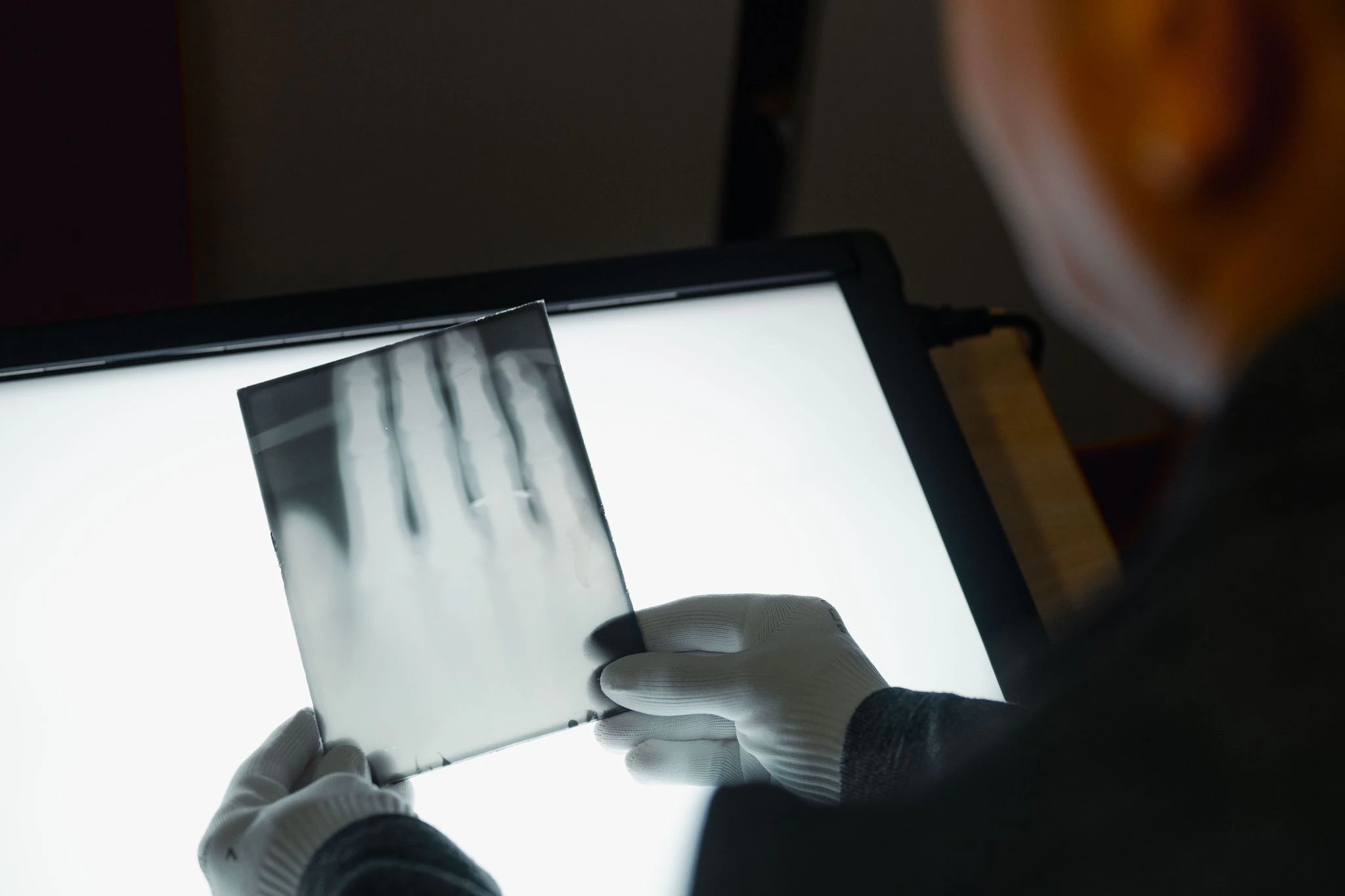 Ein Röntgenbild der Hand von Wilhelm Röntgen gehört nun zum Unesco-Weltdokumentenerbe. (Archivbild) — © Marius Becker/dpa
